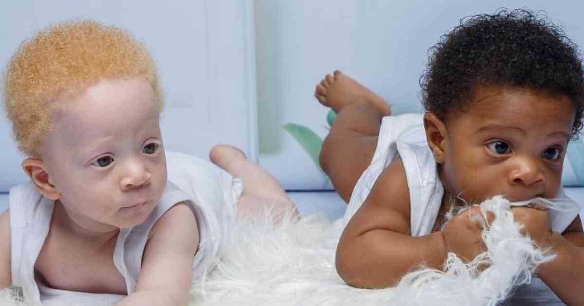Une Mère Remet les Pendules à L’Heure à Propos de ses Jumeaux Identiques Biologiquement ” Noirs et Blancs “