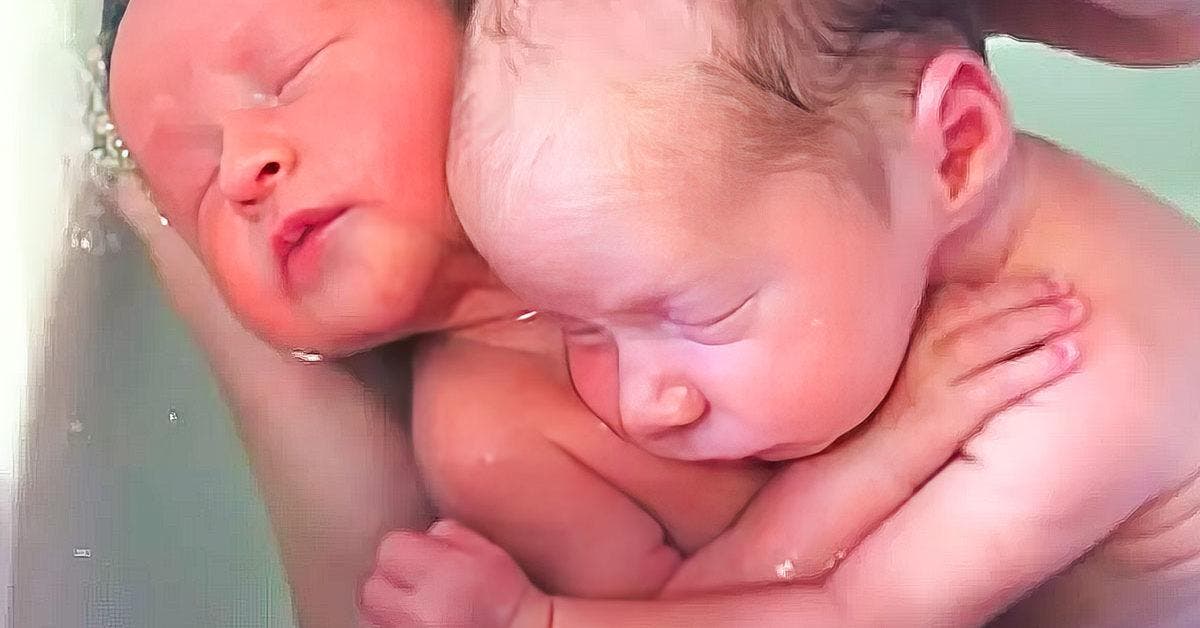 Des jumeaux arrivent au monde et continuent de s’enlacer comme dans l’utérus