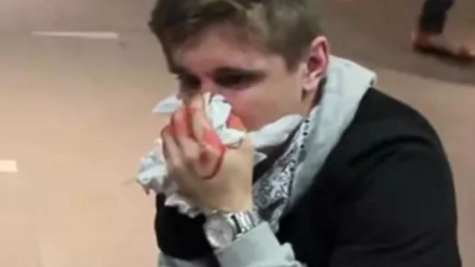 Un YouTubeur se retrouve avec le nez cassé après un mauvais tour